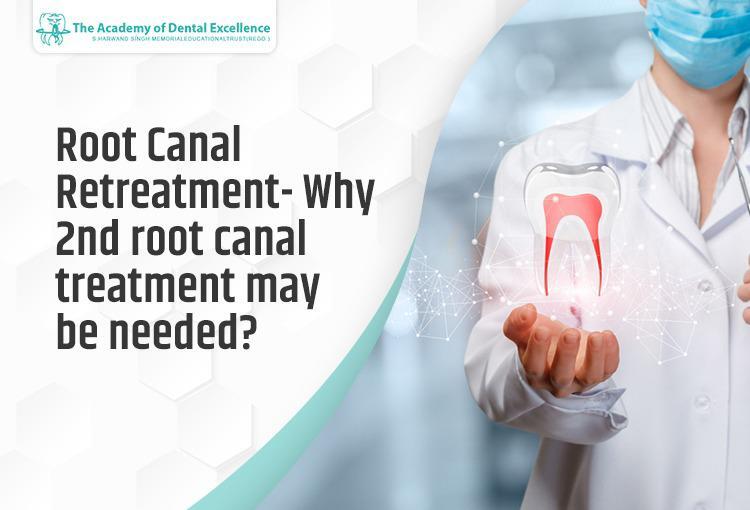 Root Canal Retreatment- Why 2nd root canal treatment may be needed?