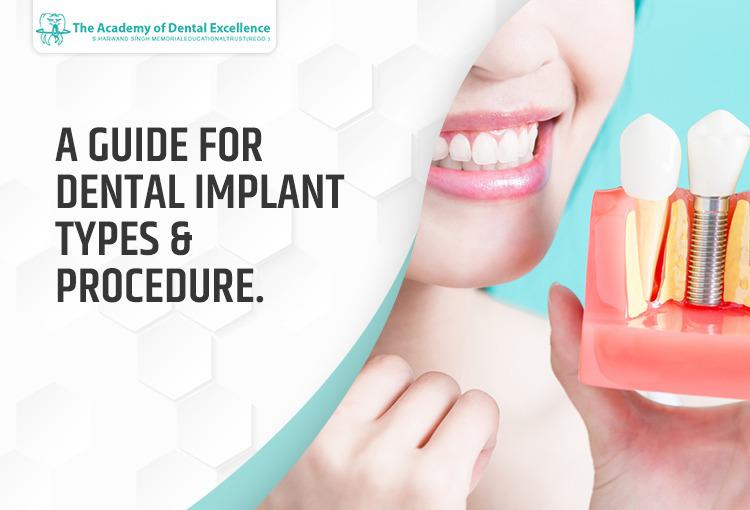 A GUIDE FOR DENTAL IMPLANT TYPES AND PROCEDURE